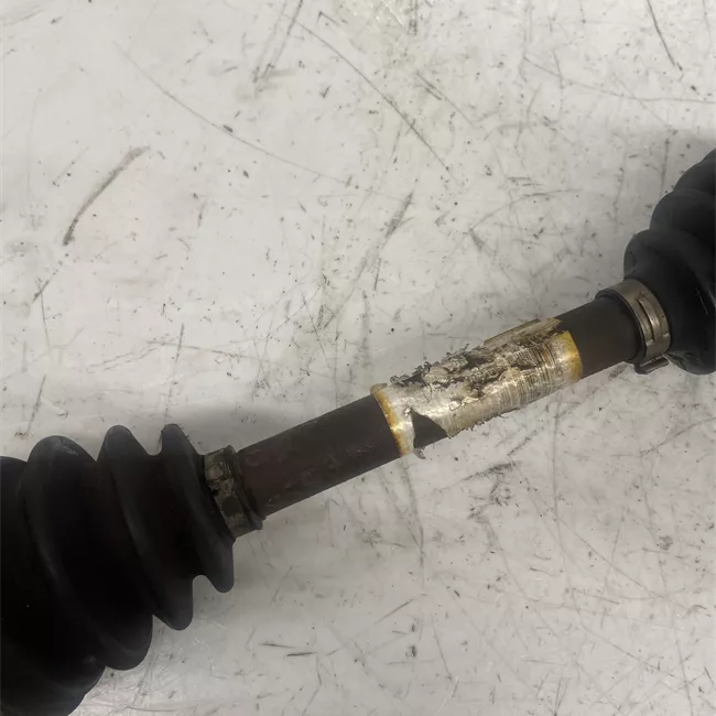 Semialbero anteriore completo sinistro